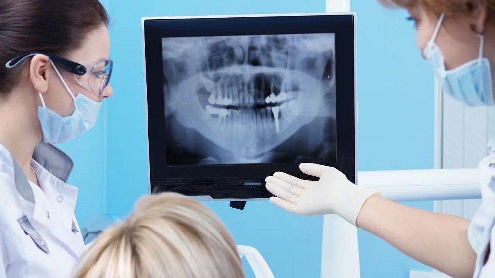 Digital Dentistry and Dental Implants: Raising the Standard of Oral Care