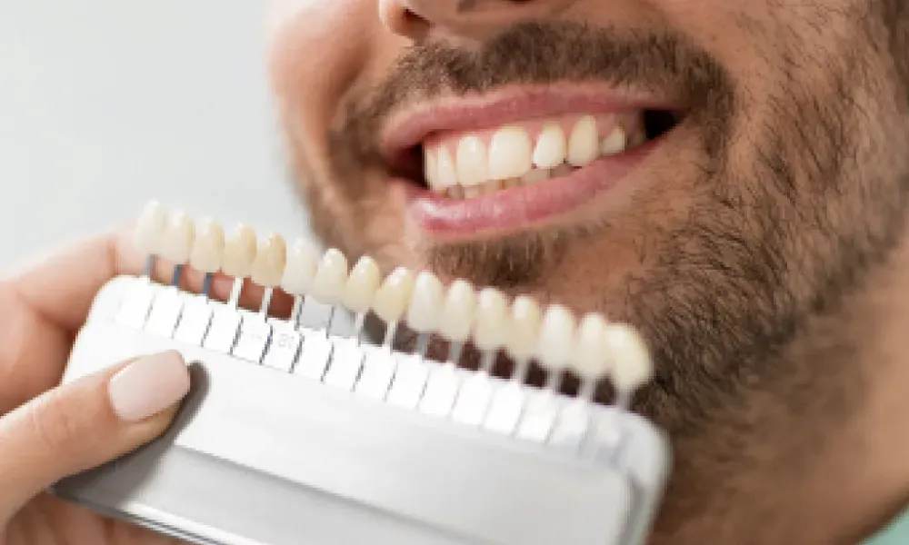 Transform Your Smile with Dental Veneers in Beachwood